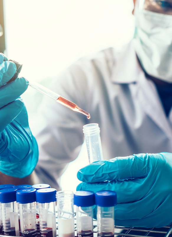 Test Sensibilità Alimentari